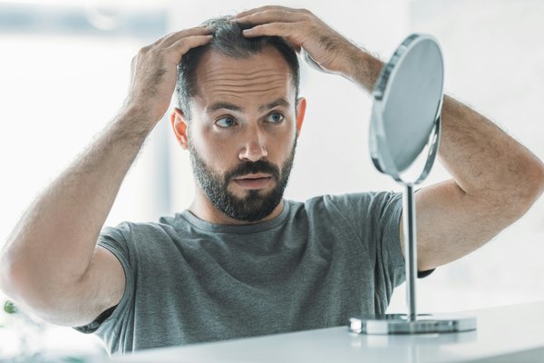 Astuces pour lutter contre la perte de cheveux chez l'homme